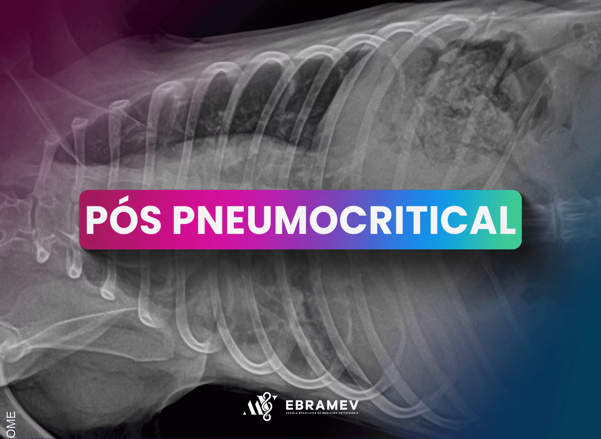 PNEUMOCRITICAL